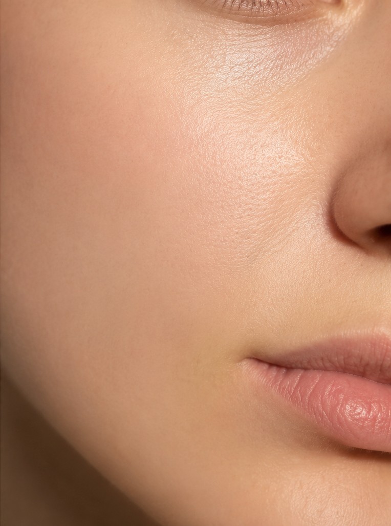 Peau après 30 jours de suivi avec Skin Progress